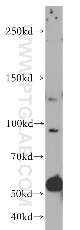 Western Blot (WB) analysis of MCF-7 cells using VCPIP1 Polyclonal antibody (17802-1-AP)