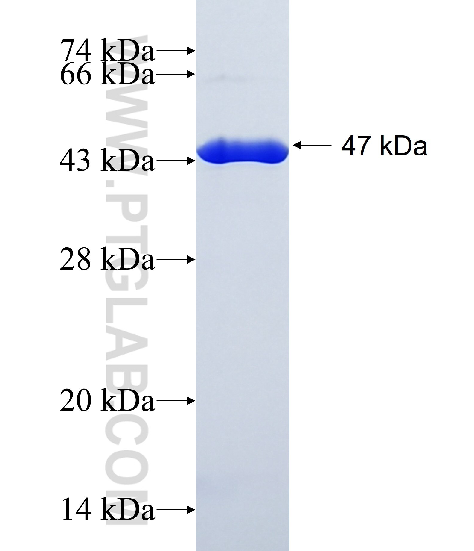 VCX fusion protein Ag39915 SDS-PAGE