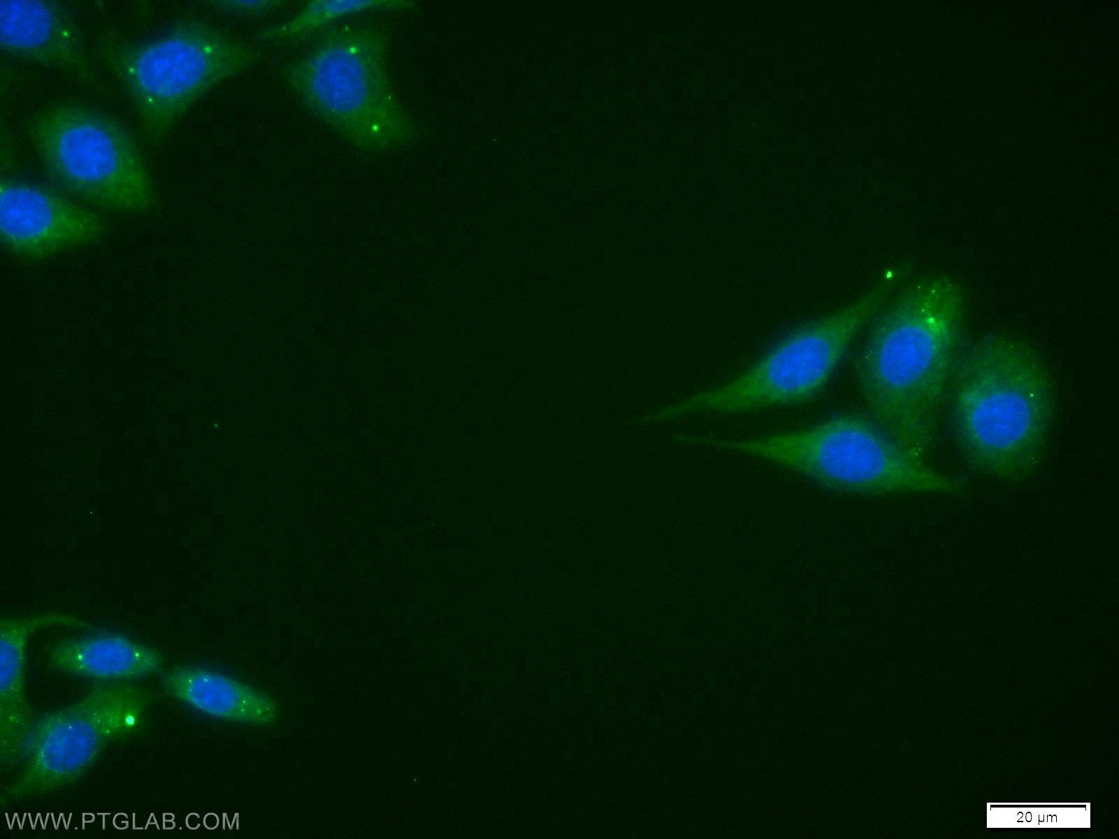 VDAC1/2 Polyclonal antibody