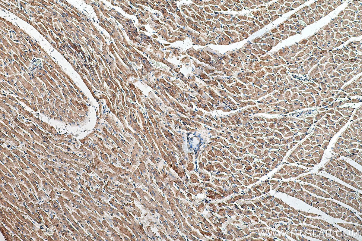 Immunohistochemistry (IHC) staining of mouse heart tissue using VDAC1/2 Polyclonal antibody (10866-1-AP)