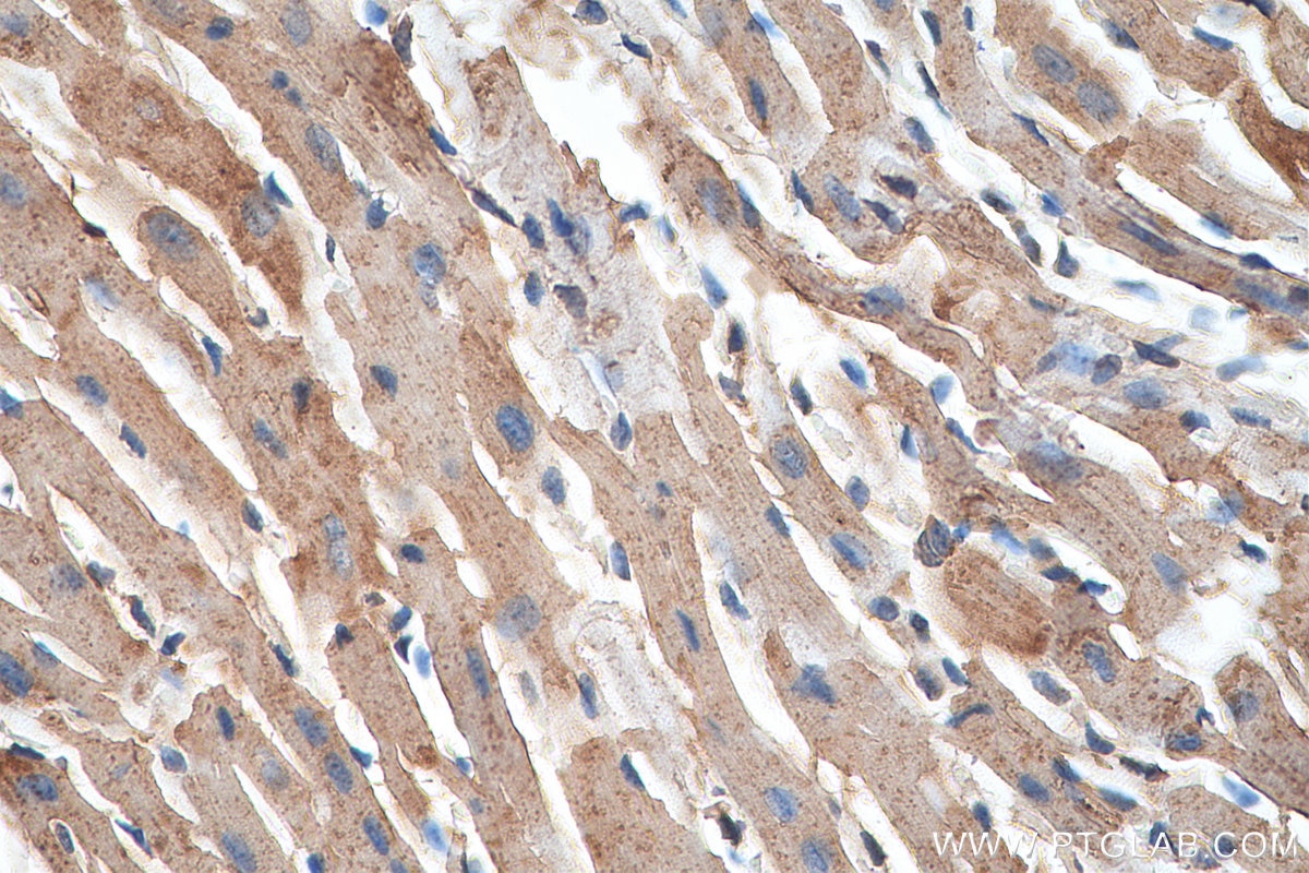 Immunohistochemistry (IHC) staining of mouse heart tissue using VDAC1/2 Polyclonal antibody (10866-1-AP)
