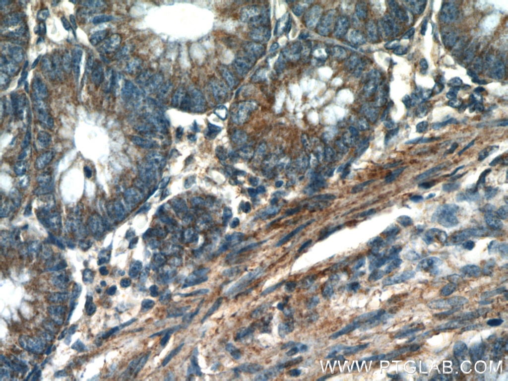 Immunohistochemistry (IHC) staining of human colon tissue using VDAC1/2 Polyclonal antibody (10866-1-AP)