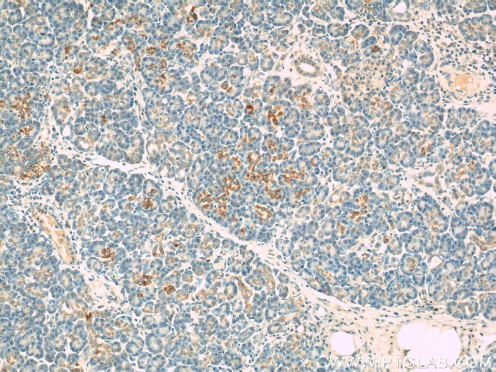 Immunohistochemistry (IHC) staining of human pancreas tissue using VDAC1/2 Polyclonal antibody (10866-1-AP)