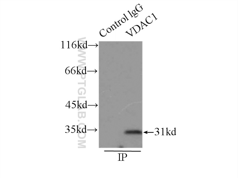 VDAC1/2 Polyclonal antibody