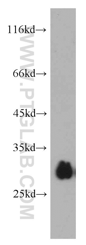Western Blot (WB) analysis of HL-60 cells using VDAC1/2 Polyclonal antibody (10866-1-AP)