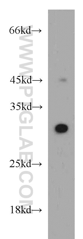 Western Blot (WB) analysis of HeLa cells using VDAC1/2 Polyclonal antibody (10866-1-AP)
