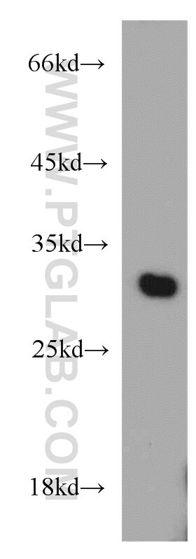 Western Blot (WB) analysis of mouse kidney tissue using VDAC1/2 Polyclonal antibody (10866-1-AP)
