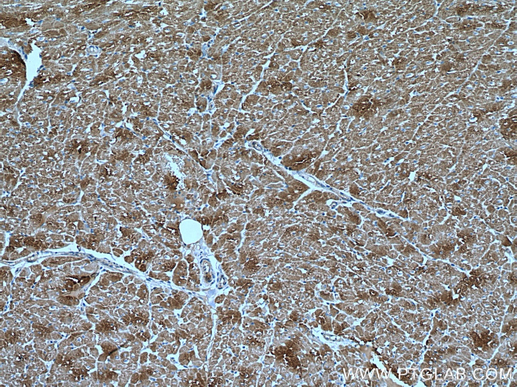 Immunohistochemistry (IHC) staining of human heart tissue using VDAC1/Porin Polyclonal antibody (55259-1-AP)