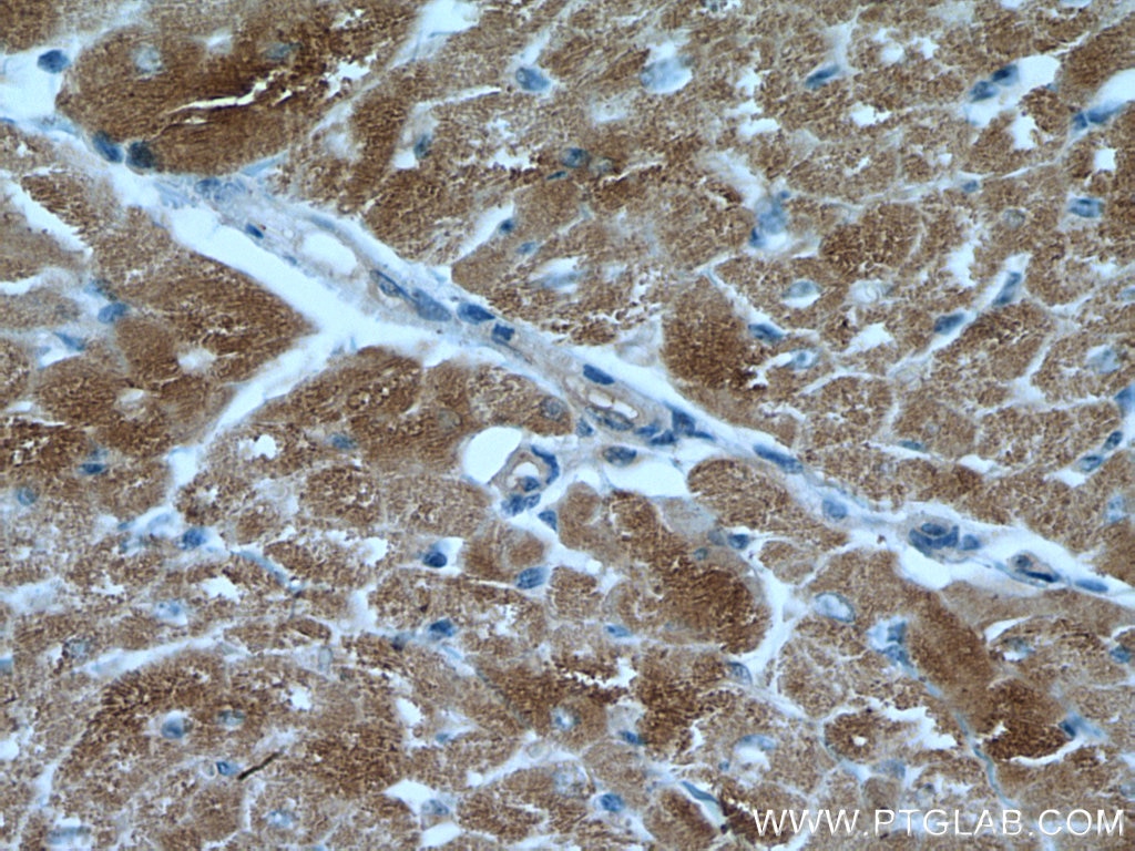 IHC staining of human heart using 55259-1-AP