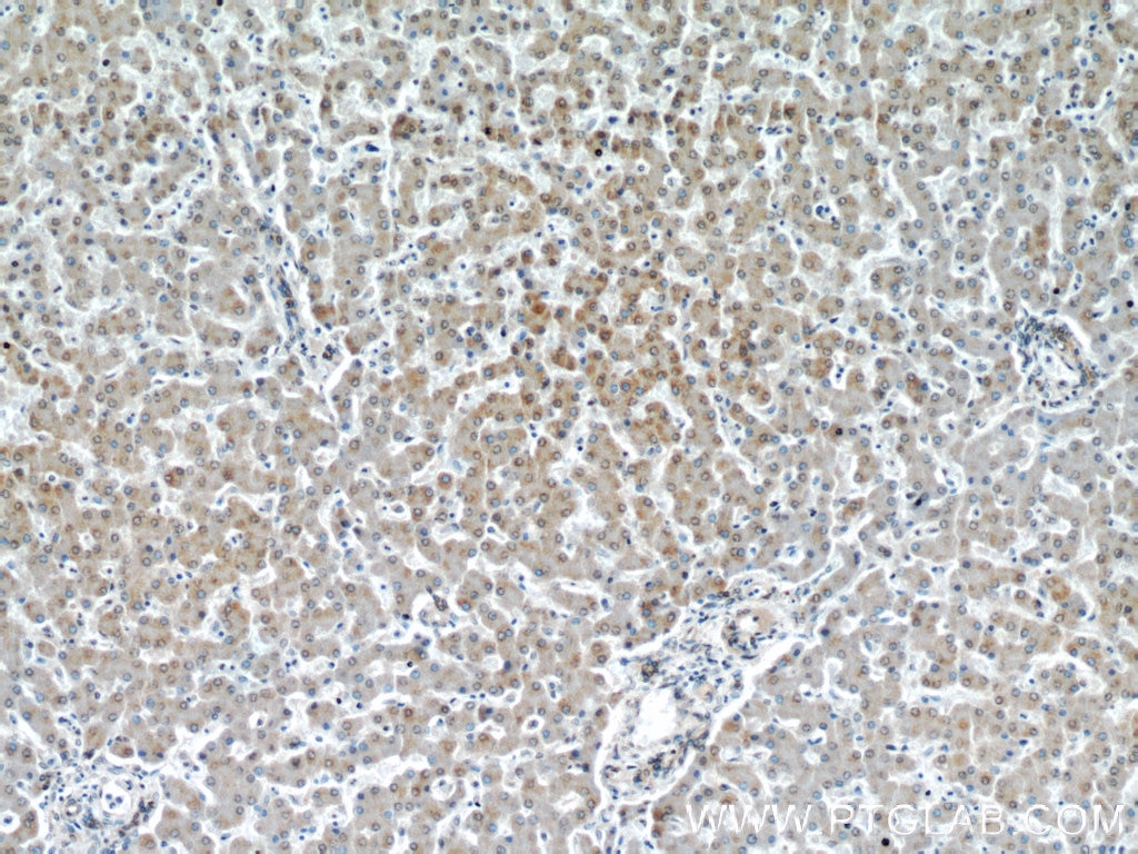 Immunohistochemistry (IHC) staining of human liver tissue using VDAC1/Porin Polyclonal antibody (55259-1-AP)