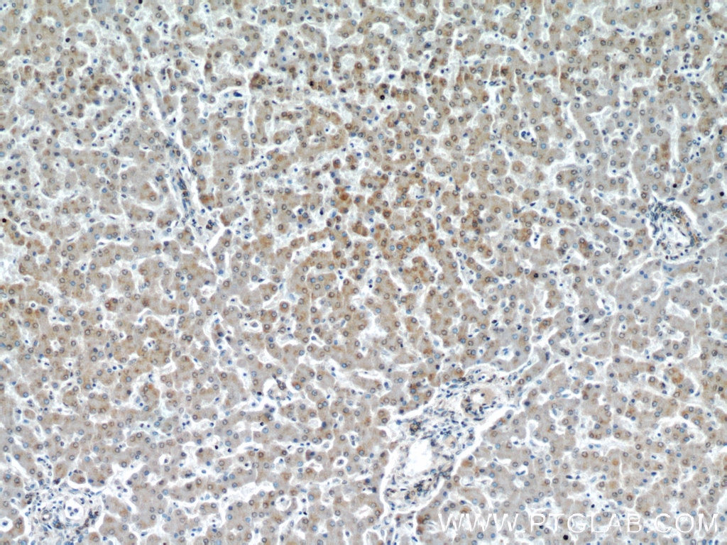 IHC staining of human liver using 55259-1-AP