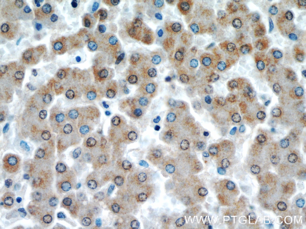 Immunohistochemistry (IHC) staining of human liver tissue using VDAC1/Porin Polyclonal antibody (55259-1-AP)