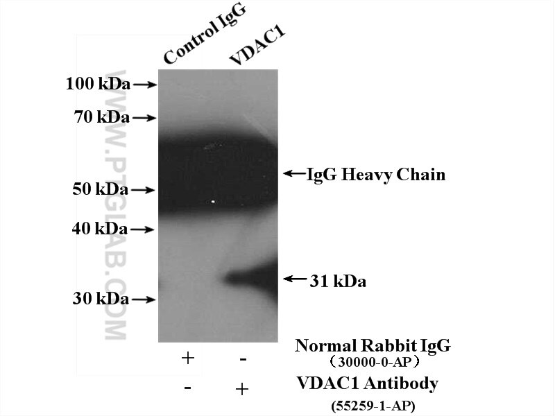 Immunoprecipitation (IP) experiment of A431 cells using VDAC1/Porin Polyclonal antibody (55259-1-AP)