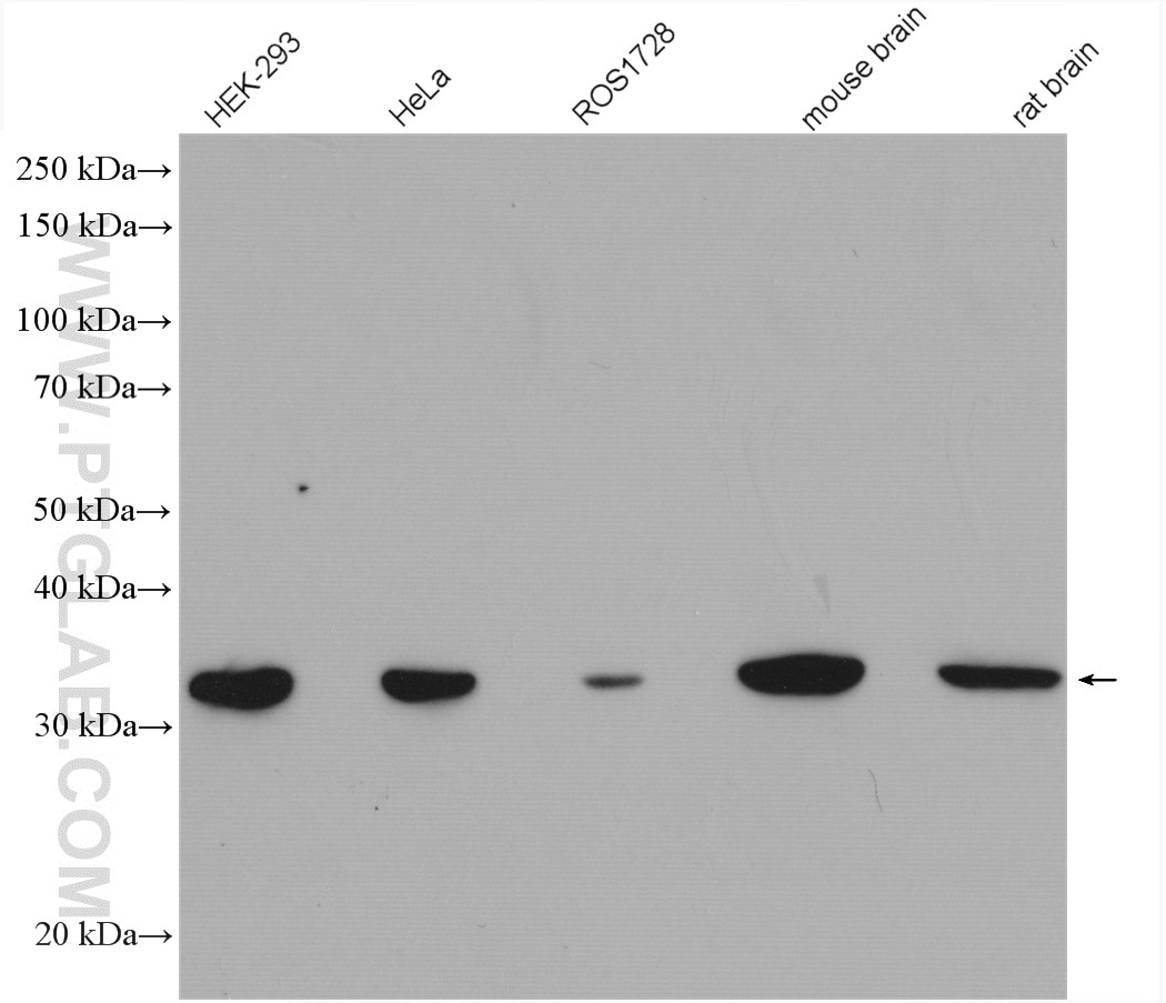 Western Blot (WB) analysis of various lysates using VDAC1/Porin Polyclonal antibody (55259-1-AP)