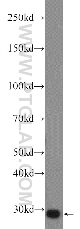 Western Blot (WB) analysis of rat liver tissue using VDAC1/Porin Polyclonal antibody (55259-1-AP)