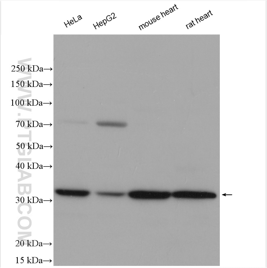 Western Blot (WB) analysis of various lysates using VDAC1/Porin Polyclonal antibody (55259-1-AP)