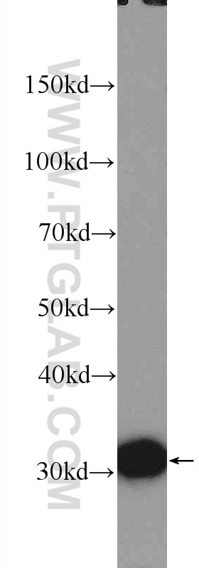 Western Blot (WB) analysis of mouse liver tissue using VDAC1/Porin Polyclonal antibody (55259-1-AP)