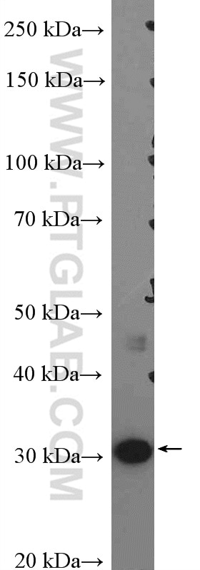 Western Blot (WB) analysis of A431 cells using VDAC1/Porin Polyclonal antibody (55259-1-AP)