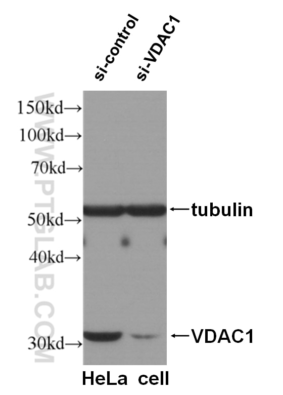 Western Blot (WB) analysis of HeLa cells using VDAC1/Porin Polyclonal antibody (55259-1-AP)