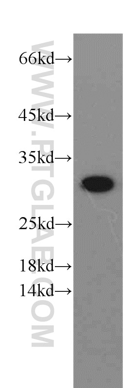 Western Blot (WB) analysis of HepG2 cells using VDAC1/Porin Polyclonal antibody (55259-1-AP)