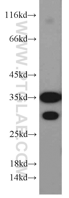 Western Blot (WB) analysis of human skeletal muscle tissue using VDAC1/Porin Polyclonal antibody (55259-1-AP)