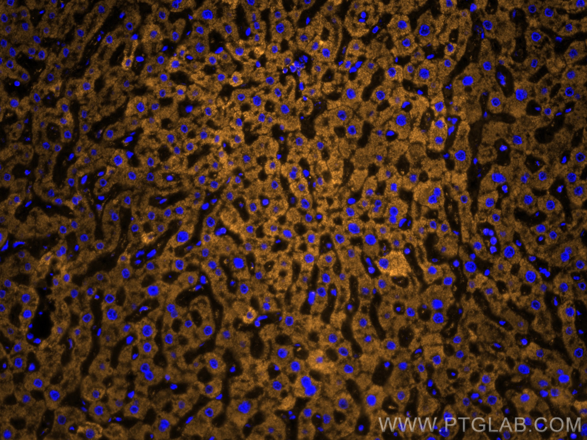 Immunofluorescence (IF) / fluorescent staining of human liver tissue using VDAC1/Porin Recombinant antibody (81538-1-RR)
