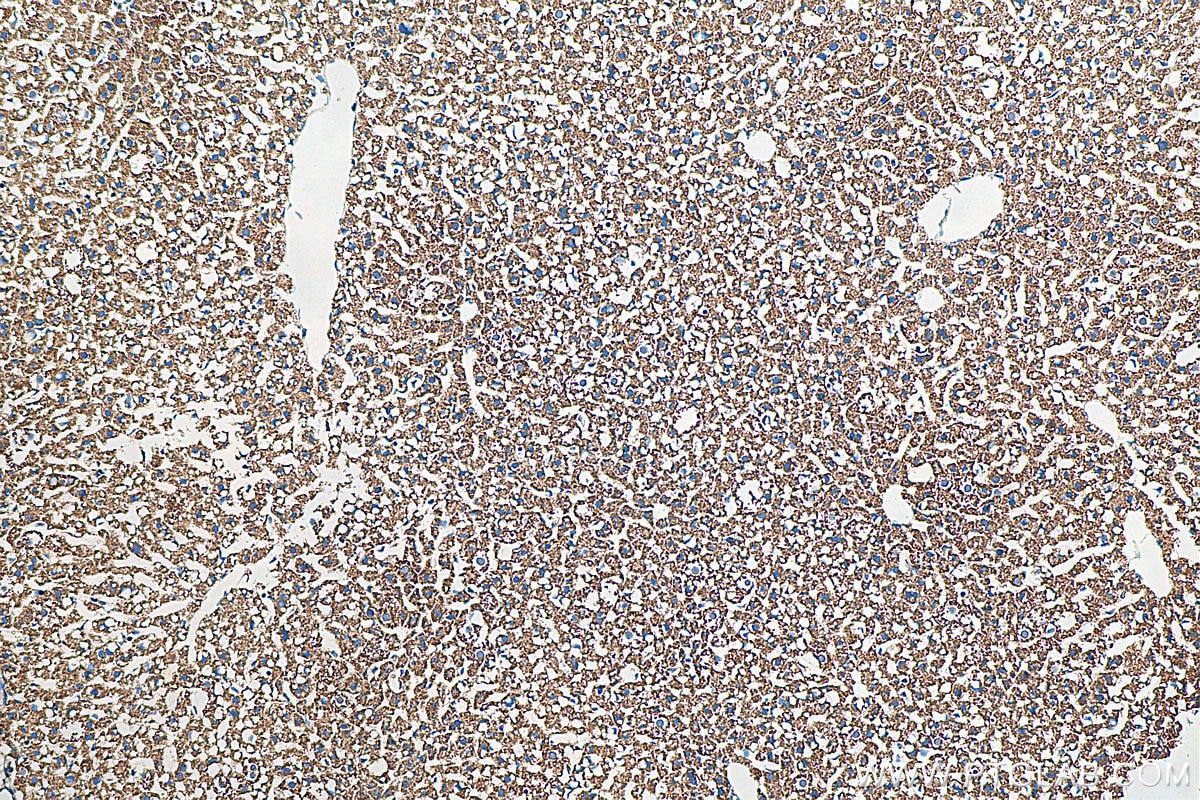 IHC staining of mouse liver using 81538-1-RR