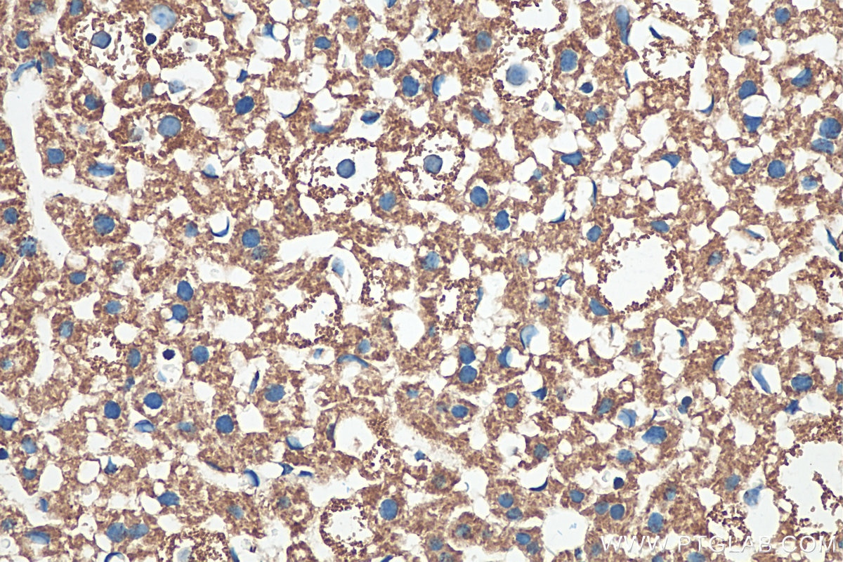 Immunohistochemistry (IHC) staining of mouse liver tissue using VDAC1/Porin Recombinant antibody (81538-1-RR)