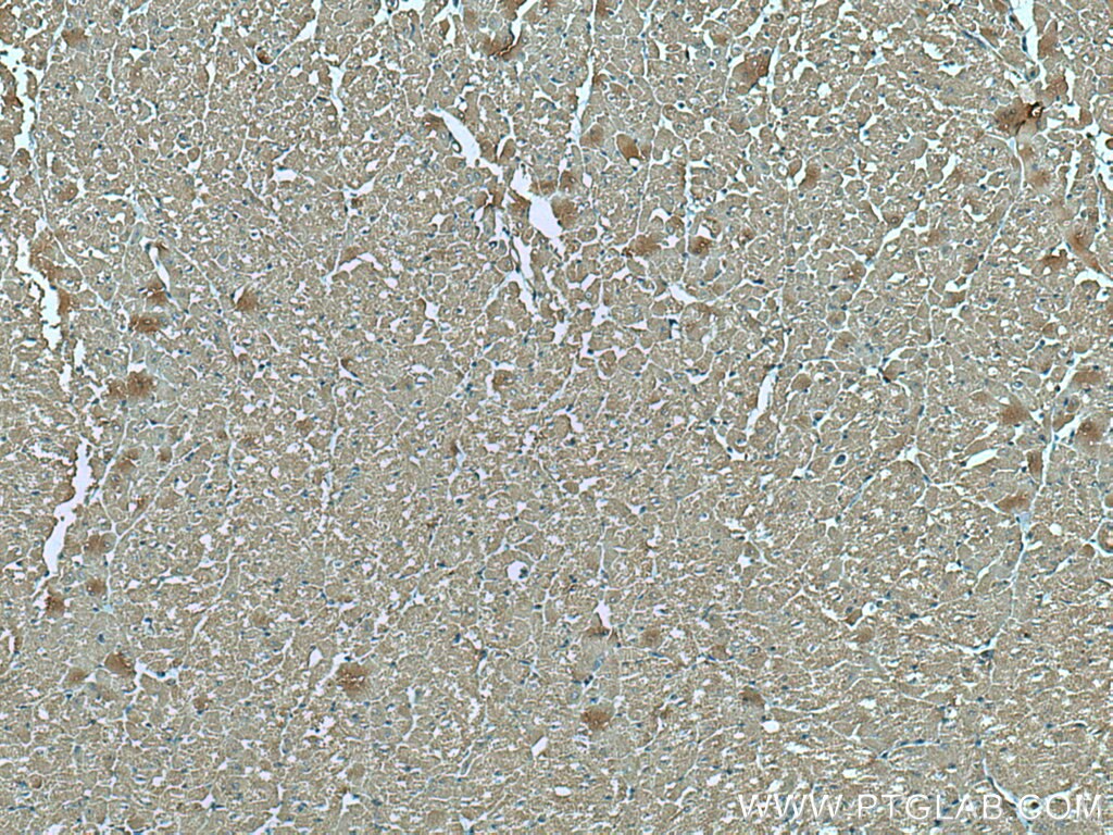 Immunohistochemistry (IHC) staining of human heart tissue using VDAC1/Porin Monoclonal antibody (66345-1-Ig)