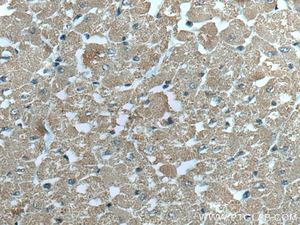 Immunohistochemistry (IHC) staining of human heart tissue using VDAC1/Porin Monoclonal antibody (66345-1-Ig)