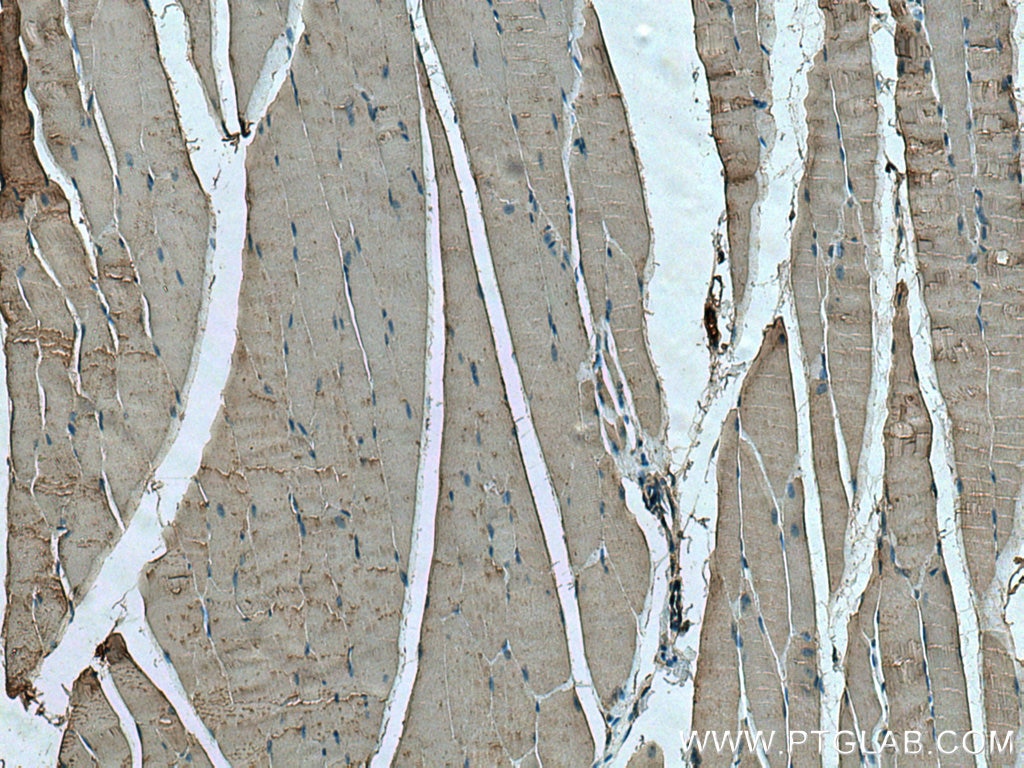 IHC staining of mouse skeletal muscle using 66345-1-Ig
