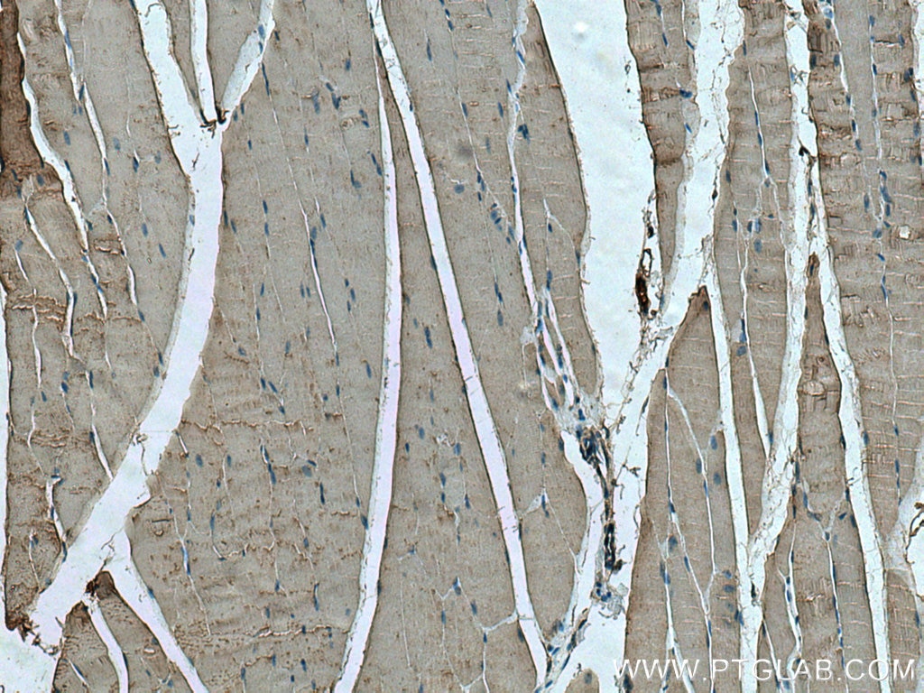 Immunohistochemistry (IHC) staining of mouse skeletal muscle tissue using VDAC1/Porin Monoclonal antibody (66345-1-Ig)