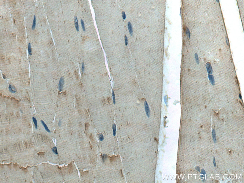 IHC staining of mouse skeletal muscle using 66345-1-Ig