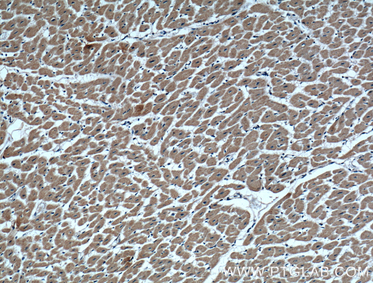 VDAC1/Porin Monoclonal antibody