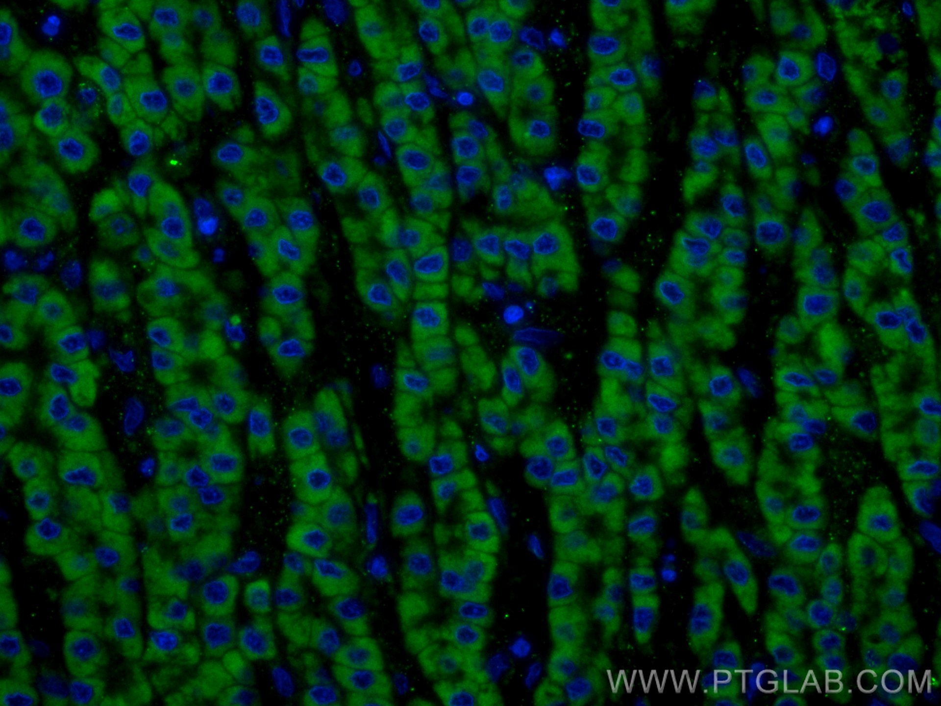 IF Staining of human liver cancer using CL488-55259