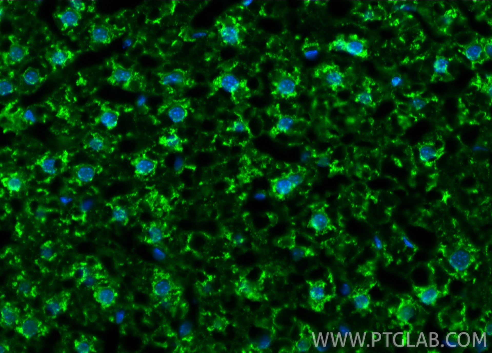 Immunofluorescence (IF) / fluorescent staining of mouse liver tissue using CoraLite® Plus 488-conjugated VDAC1/Porin Recombin (CL488-81538)