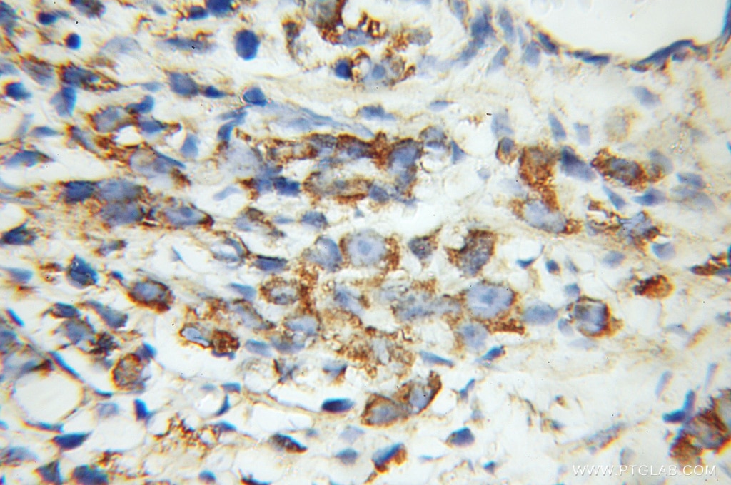 VDAC1/2/3 Polyclonal antibody