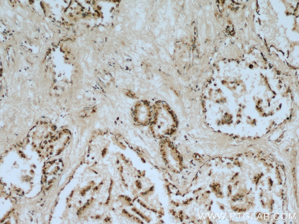 Immunohistochemistry (IHC) staining of human prostate tissue using VDAC1/2/3 Polyclonal antibody (11663-1-AP)