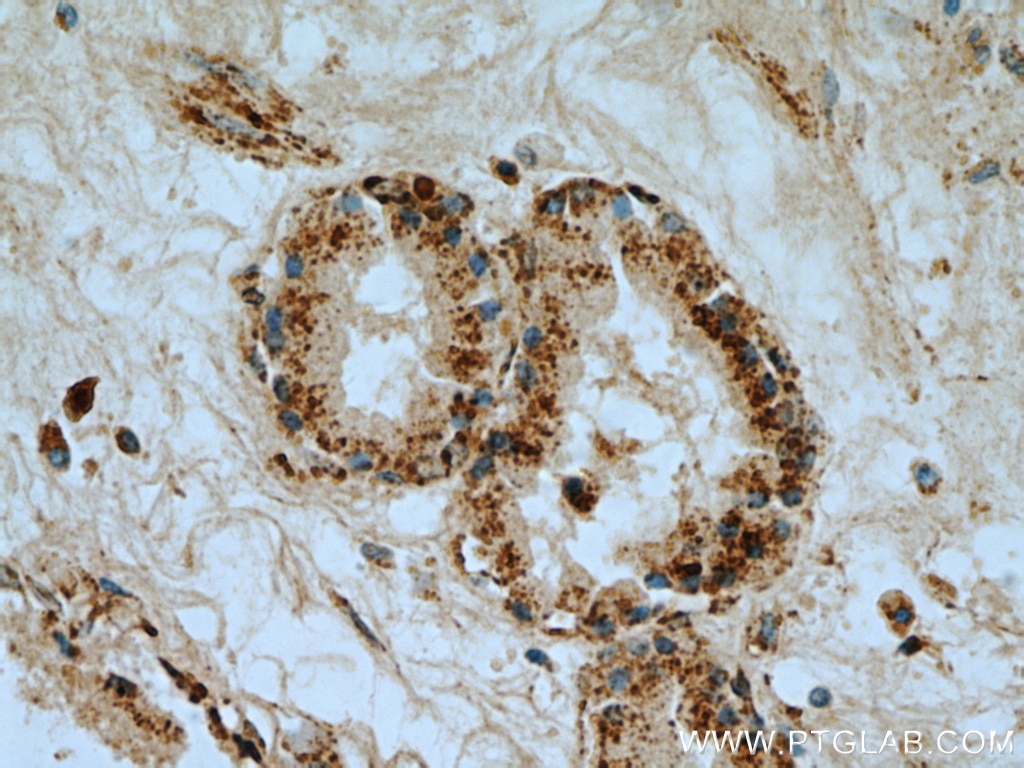Immunohistochemistry (IHC) staining of human prostate tissue using VDAC2 Polyclonal antibody (11663-1-AP)