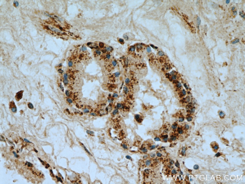 Immunohistochemistry (IHC) staining of human prostate tissue using VDAC1/2/3 Polyclonal antibody (11663-1-AP)