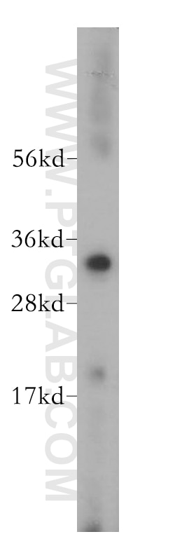 Western Blot (WB) analysis of human heart tissue using VDAC1/2/3 Polyclonal antibody (11663-1-AP)