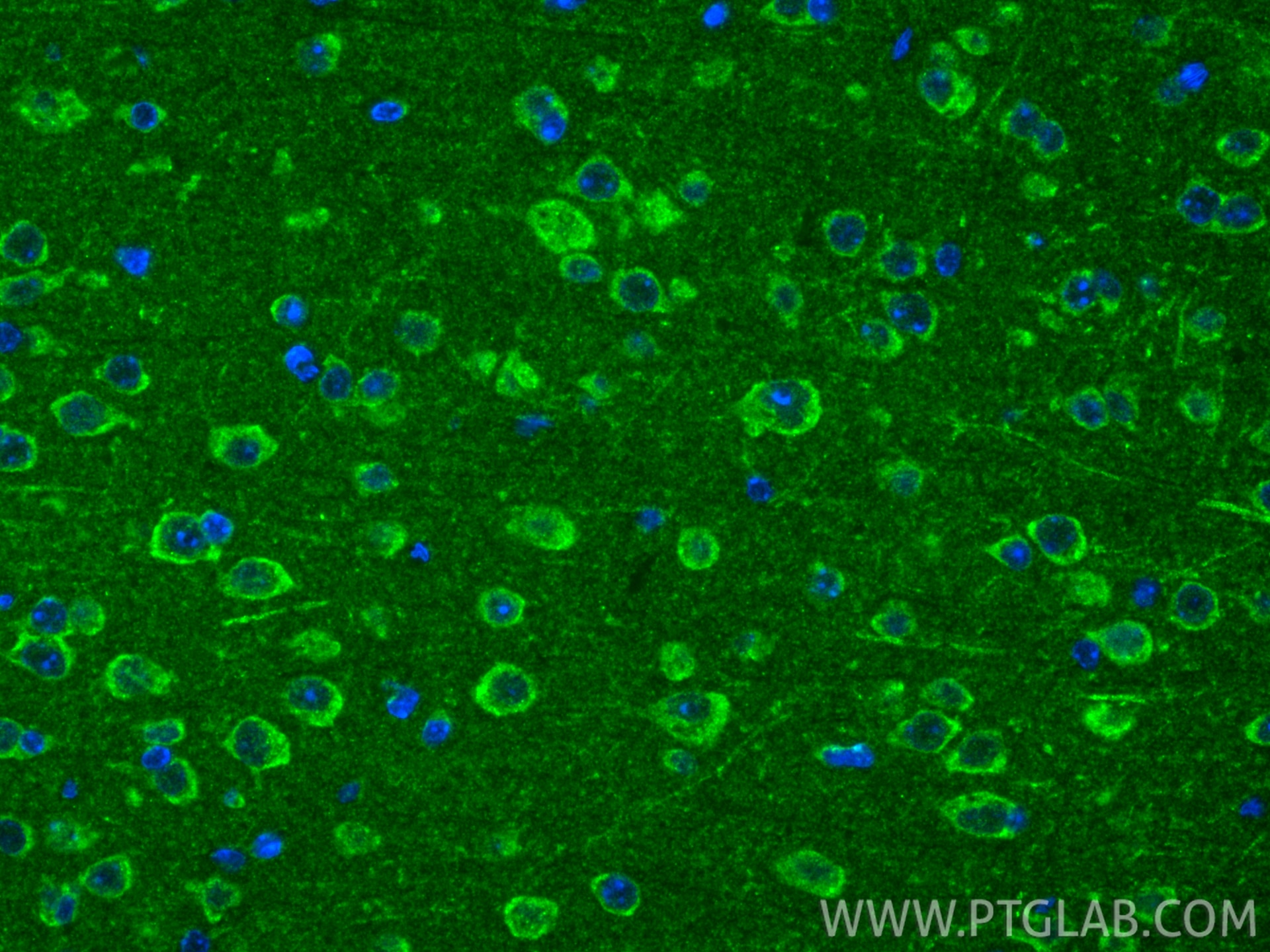 IF Staining of mouse brain using 55261-1-AP Immunofluorescence (IF) / fluorescent staining of mouse brain tissue using VDAC2 Polyclonal antibody (55261-1-AP)