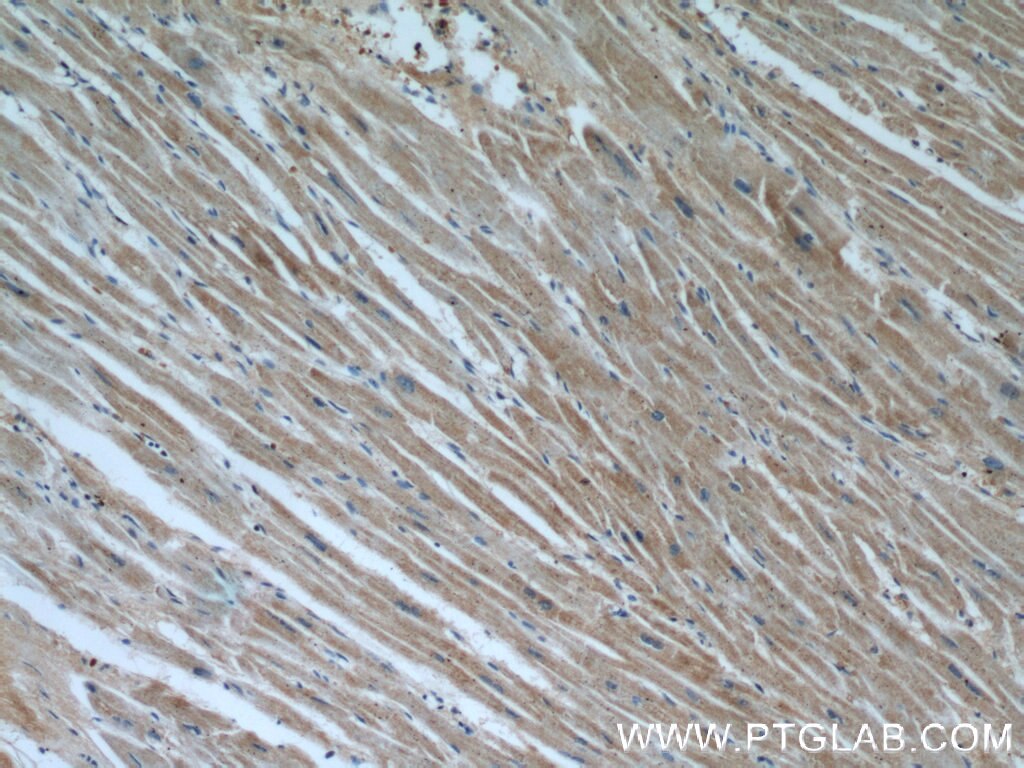 Immunohistochemistry (IHC) staining of human heart tissue using VDAC2 Polyclonal antibody (55261-1-AP)