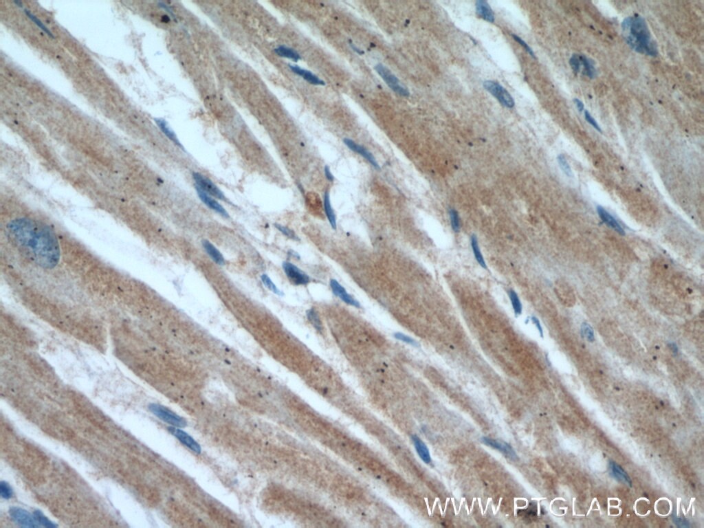 Immunohistochemistry (IHC) staining of human heart tissue using VDAC2 Polyclonal antibody (55261-1-AP)