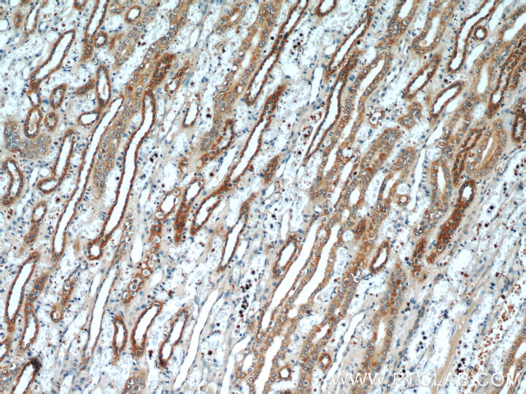 Immunohistochemistry (IHC) staining of human kidney tissue using VDAC2 Polyclonal antibody (55261-1-AP)