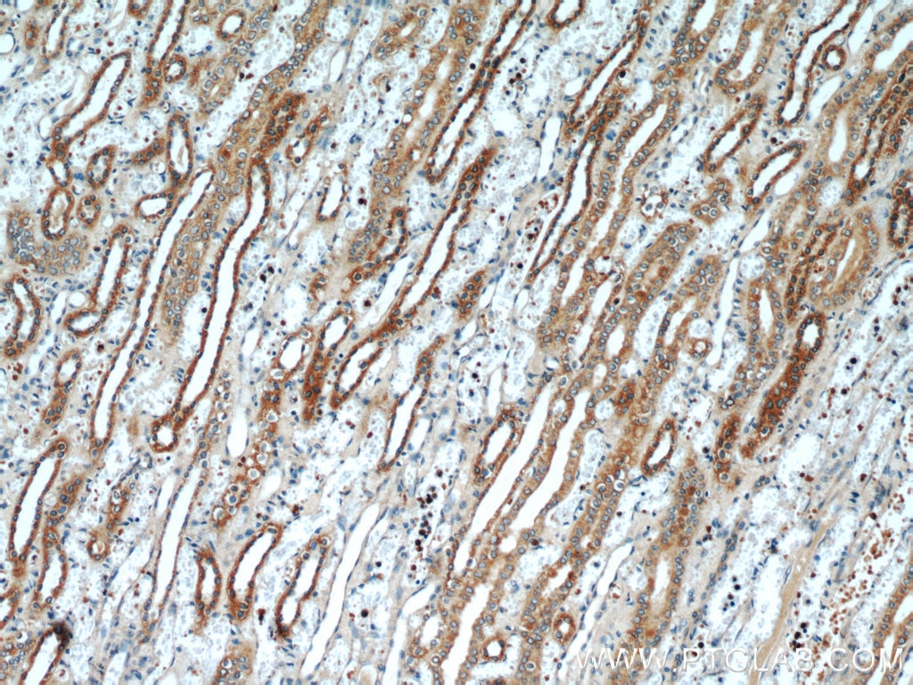 IHC staining of human kidney using 55261-1-AP