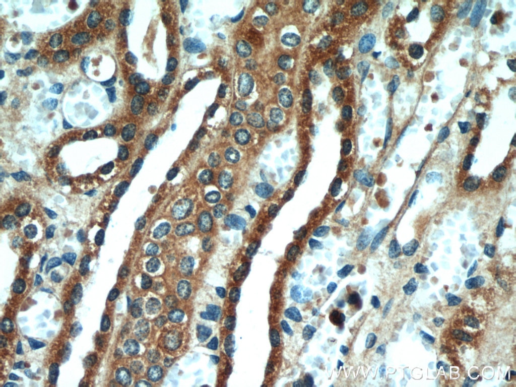 Immunohistochemistry (IHC) staining of human kidney tissue using VDAC2 Polyclonal antibody (55261-1-AP)