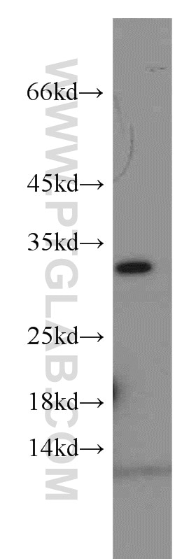 Western Blot (WB) analysis of mouse brain tissue using VDAC2 Polyclonal antibody (55261-1-AP)