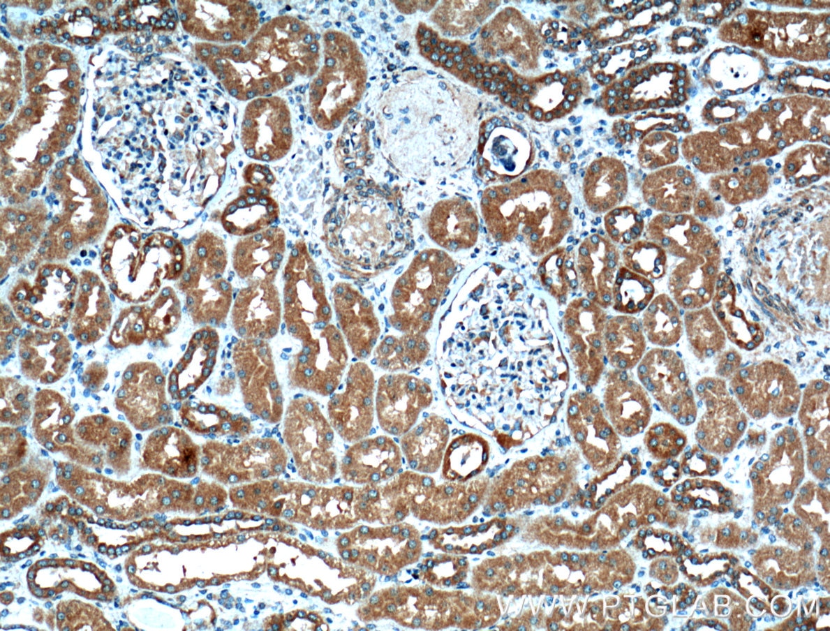 IHC staining of human kidney using 66388-1-Ig