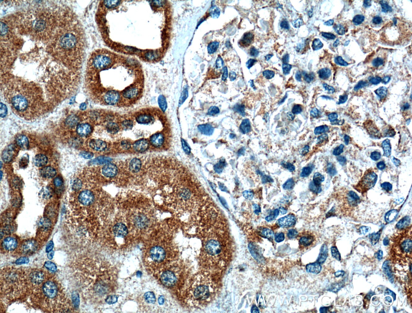 Immunohistochemistry (IHC) staining of human kidney tissue using VDAC2 Monoclonal antibody (66388-1-Ig)